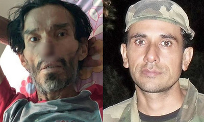 Pedro Juan Caballero: Hombre niega ser Alejandro Ramos y autoridades buscan a sus familiares - OviedoPress
