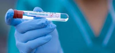 Salud Pública detecta 384 nuevos contagios y 22 muertes por Covid-19