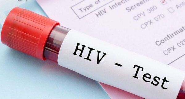 Logran eliminar el VIH en seis pacientes con el trasplante de células madre