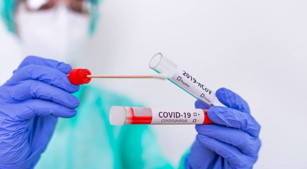 Coronavirus: 20 fallecidos, 746 internados y 244 en terapia intensiva