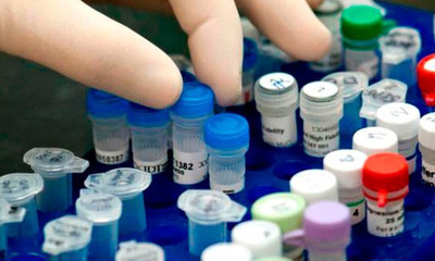 Descubren que medicinas para VIH pueden combatir problemas neurológicos - OviedoPress