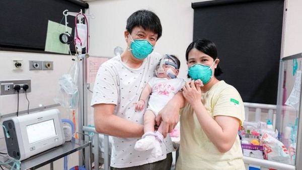 ¡Milagro! Bebé que nació con 212 gramos de peso se va a casa tras 13 meses hospitalizada