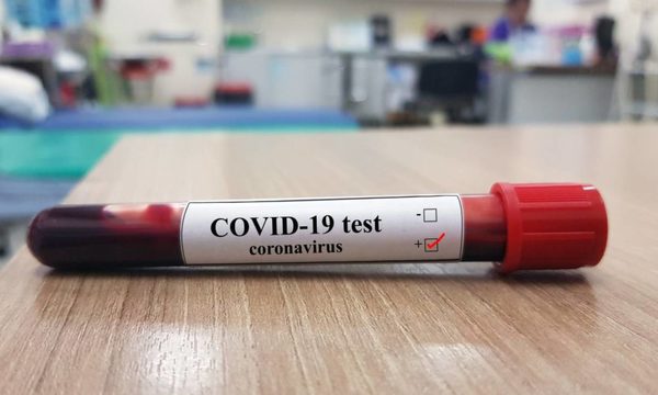 Coronavirus: 19 finados y 193 contagiados