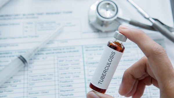 ¡Todo lo que tenés que saber sobre la tuberculosis!