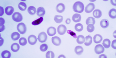 Diario HOY | Descubren cómo el parásito de la malaria se defiende de la fiebre