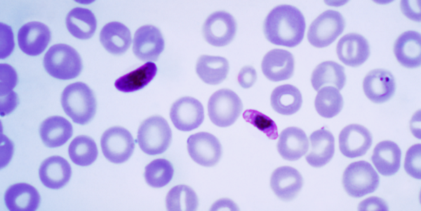 Diario HOY | Descubren cómo el parásito de la malaria se defiende de la fiebre