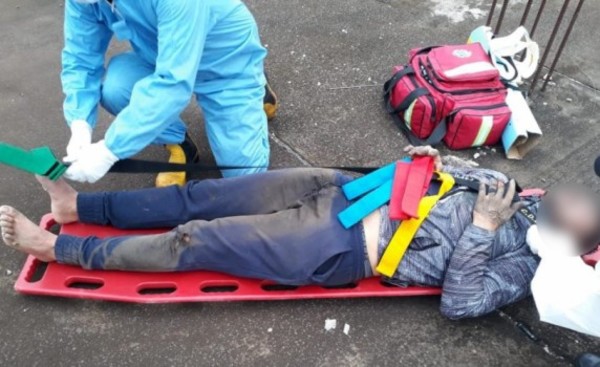 Joven que sufrió descarga eléctrica podría perder la mano y el pie