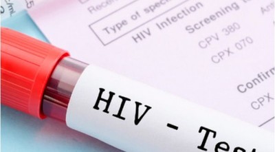 Diagnóstico y tratamiento para personas con VIH están garantizados