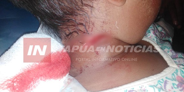 SALVAJE: TIA MACHETEÓ EN EL CUELLO A SU SOBRINO TRAS DISCUSIÓN