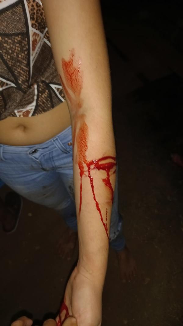 Concepción: Pelea entre vecinos termina con dos menores agredidas