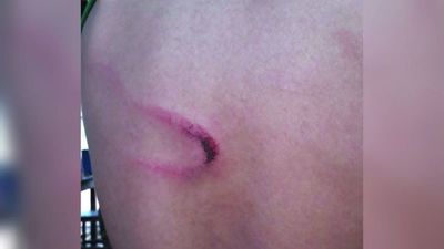 Chico de 14 años ligó una terrible golpiza