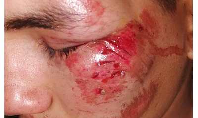 Joven resulta herido tras ser embestido por un automóvil - Noticiero Paraguay