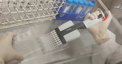 La Nación / Laboratorio central detectó microorganismos ambientales causantes de infecciones