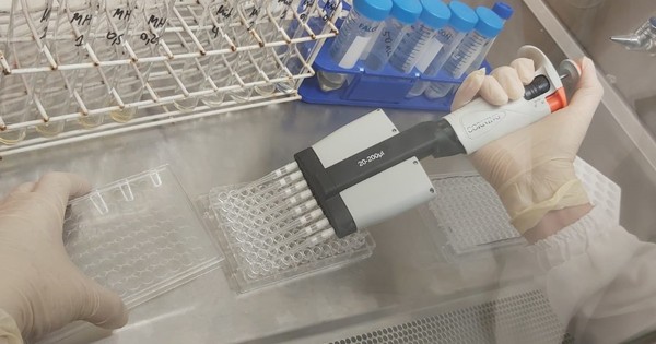 La Nación / Laboratorio central detectó microorganismos ambientales causantes de infecciones