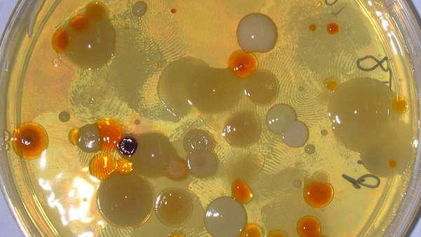 Bacterias sobreviven 1.000 días sin comer y podrían hacerlo hasta 100.000 años | Ñanduti