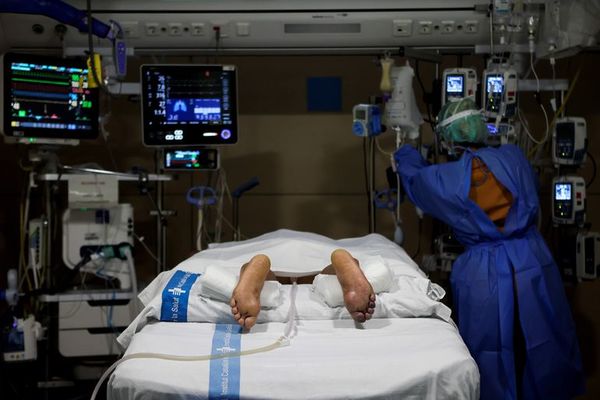 Poner a pacientes boca abajo reduce necesidad de intubación y su mortalidad - Ciencia - ABC Color