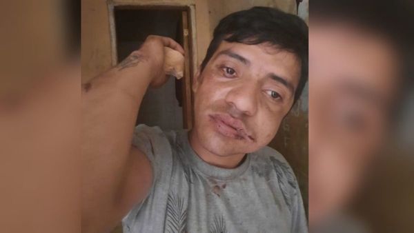 Lo confundieron con un ladrón y le reventaron la mandíbula