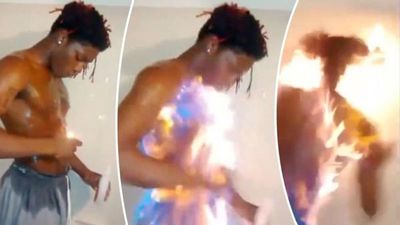 Atenti: Un escolar se quemó con un juego viral en Tik Tok
