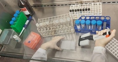 La Nación / Implementan estudio de microbacterias atípicas