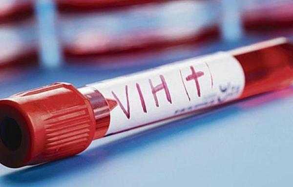 ¿Por qué debés realizarte la prueba de VIH?: ¡Aquí 5 razones!