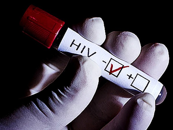 Cinco razones para hacerse la prueba de VIH