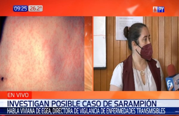 Alerta por posible caso de sarampión tras más de dos décadas | Noticias Paraguay