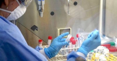 La Nación / Reportan 18 fallecidos y 86 nuevos positivos