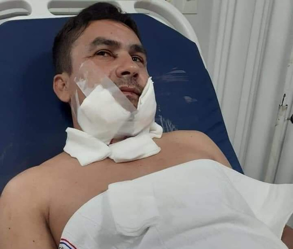 Crónica / Chofer baleado: “Creí que ya era mi final”