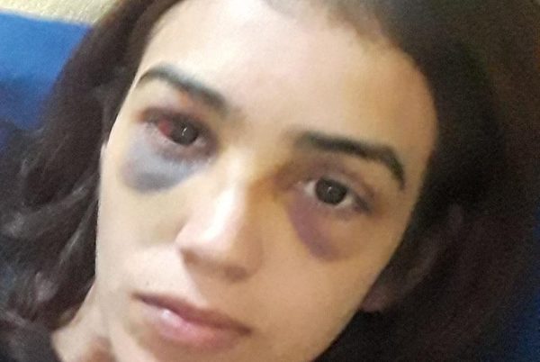 Imputado por tenencia de droga había golpeado brutalmente a su pareja – Diario TNPRESS