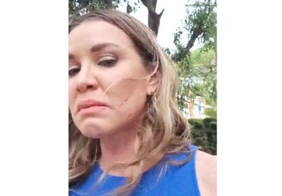 Crónica / ¡A GARROTAZOS! “Salió a atacarnos con un palo; me arañó, me agarró del pelo”