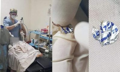 Niña tragó lámina de aluminio y tuvo problemas para respirar