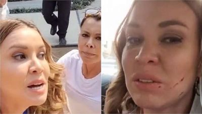 Dallys Ferreira le quiere llevar a juicio a la que le atacó