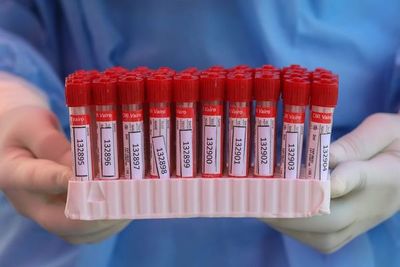 Una solución salina podría menguar los efectos del covid, dice estudio - Ciencia - ABC Color