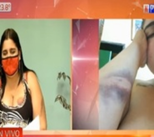 Luque: Mujer denuncia a su vecino tras terrible agresión - Paraguay.com
