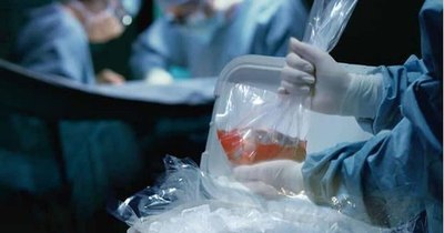 La Nación / Donación de órganos y tejidos: una lucha diaria para salvar vidas
