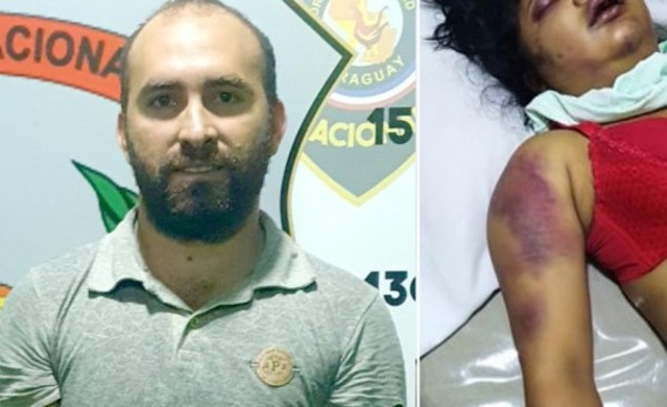 Capturan a hombre que había golpeado brutalmente a su expareja