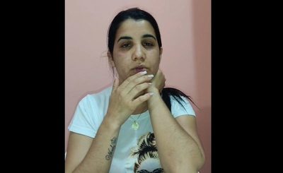 (Video). Mujer denuncia a su pareja: “fui víctima de intento de feminicidio, yo vi la muerte”