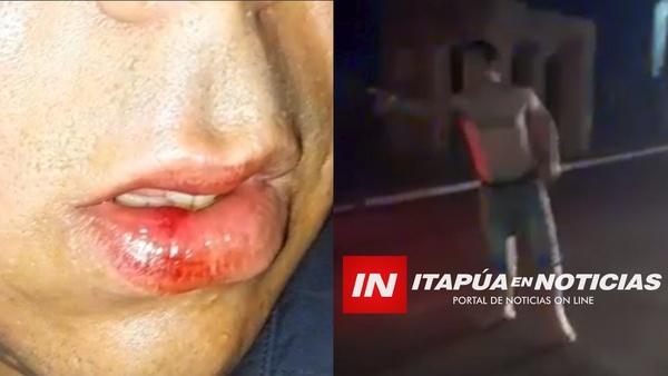 BORRACHOS AGREDIERON A POLICÍAS DURANTE UN CONTROL