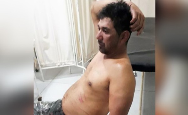 Sobrevive a tres balazos en la cabeza efectuados por su sobrino