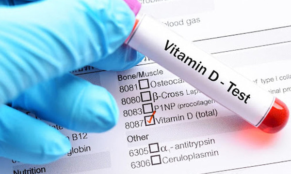 Niveles de vitamina D en la sangre determinan el riesgo de sufrir cáncer colorrectal - OviedoPress
