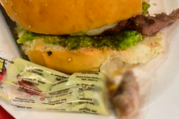 Diario HOY | Para 'chuparse los dedos': mujer encuentra resto humano dentro de su hamburguesa