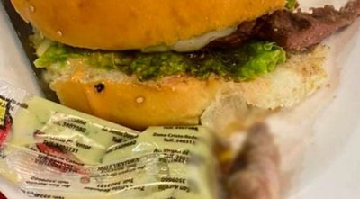 Crónica / Mujer estaba comiendo una hamburguesa y ¡encontró un dedo adentro!