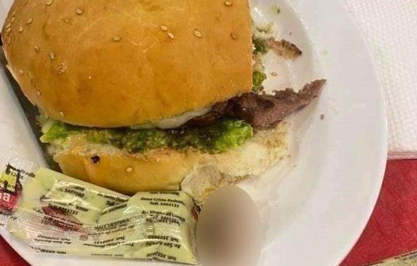 Joven encontró un dedo en una hamburguesa: “No pude dormir”