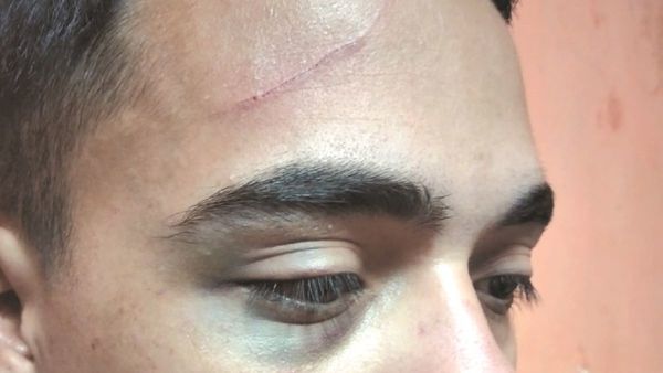 Ligó por reclamar barrullo y que orinaron por su muralla