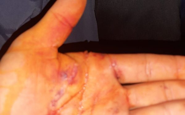 Adicto mató a anciana que le reclamó el hurto de su brasero