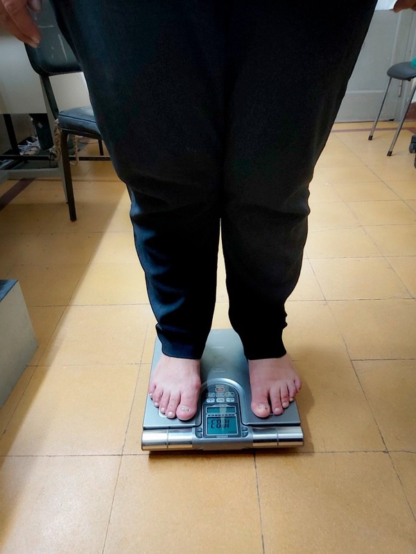 Paraguay atraviesa “preocupante epidemia de obesidad”, advierten - El Trueno