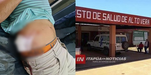 SORPRENDIÓ A SU VECINO DENTRO DE SU PATIO Y TERMINÓ CON UNA HERIDA DE BALA