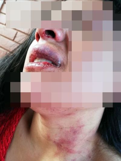 Arresto domiciliario para un hombre por agredir a mujer  - Nacionales - ABC Color