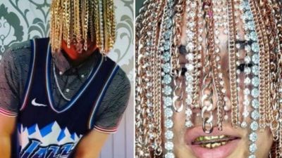 Rapero mexicano se mandó implantar cadenas de oro en la cabeza
