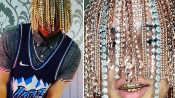 Rapero mexicano se mandó implantar cadenas de oro en la cabeza